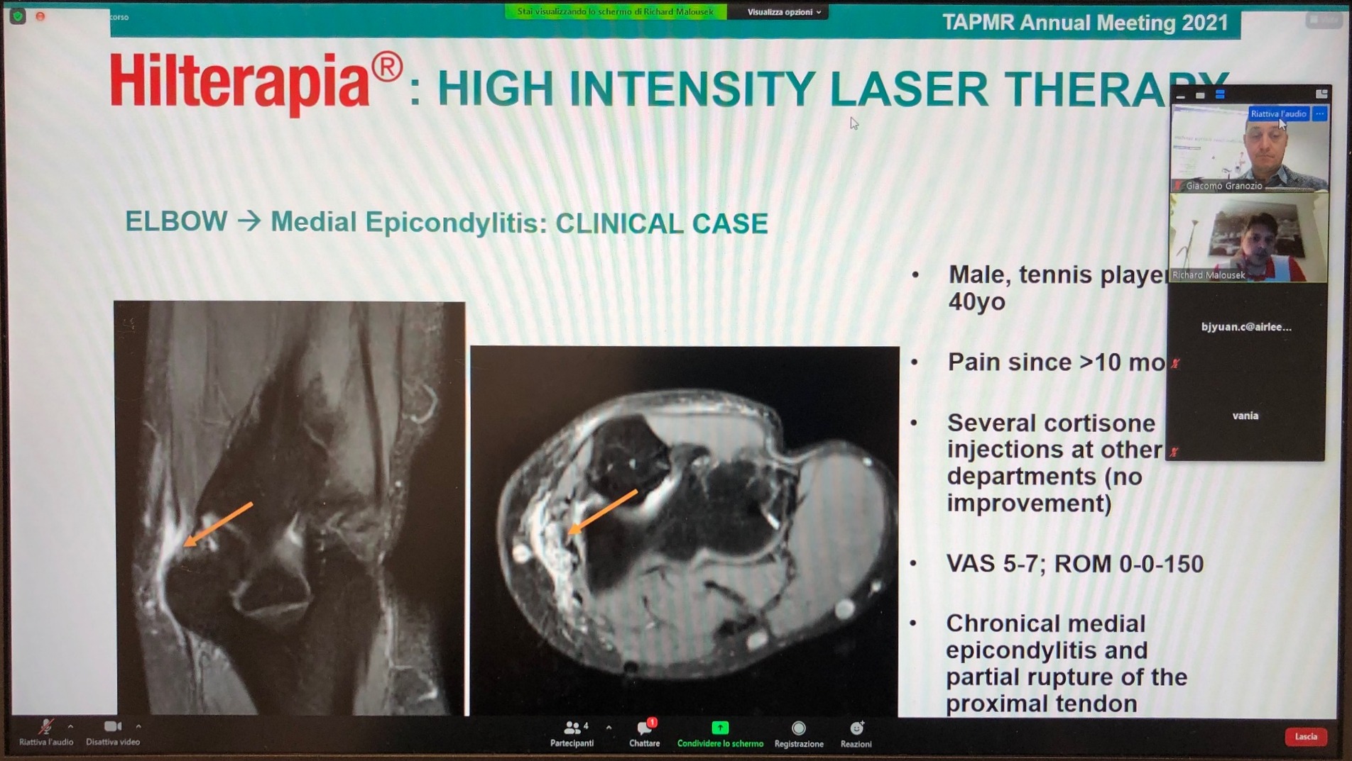 TAPRM 2021 - Hilterapia webinar with Dr Malousek