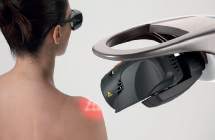 M8 laser treatment - shoulder