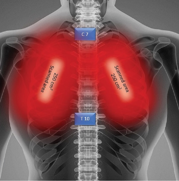 Blog - COVID19 case report - laser beam positioning