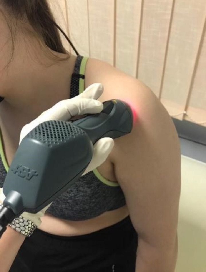MLS laser treatment for Subacromial Pain Syndrome