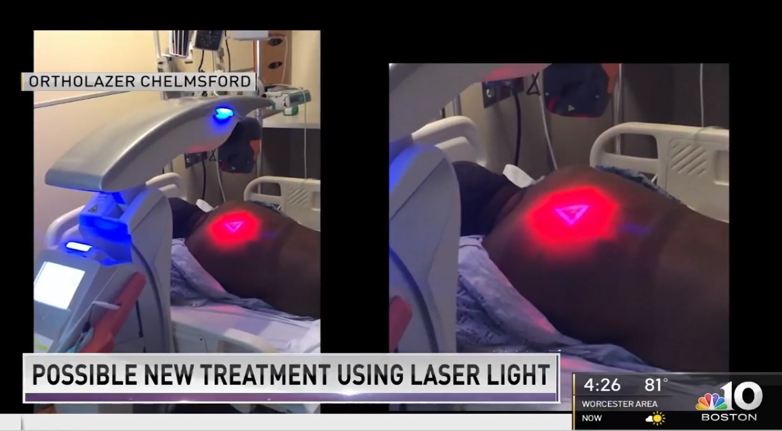 NBC Boston News - M8 laser treatment