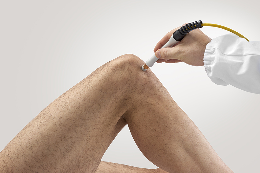 knee pain laser treatment