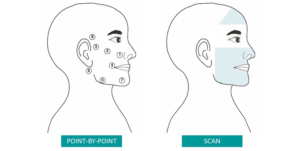 MLS treatment - adapted from Bernal 1993