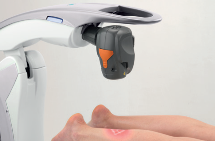 M8 automatic laser treatment