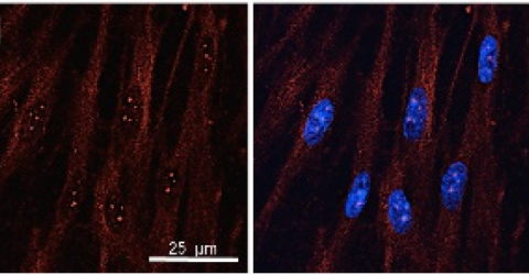 Effect of NIR Laser Therapy by MLS‐MiS Source on Fibroblast Activation by Inflammatory Cytokines in Relation to Wound Healing