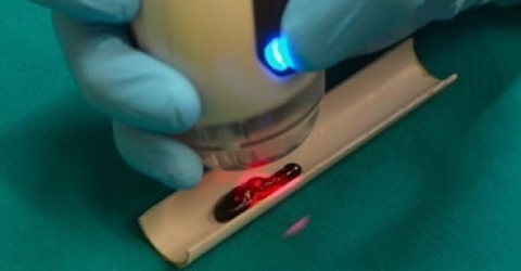 MiS laser-assisted wound care on a leech