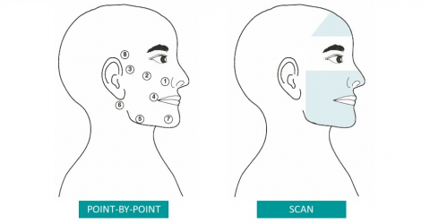 Bell's palsy - MLS laser treatment
