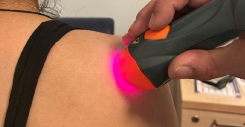 Dolore alla spalla emiplegica - trattamento laser MLS