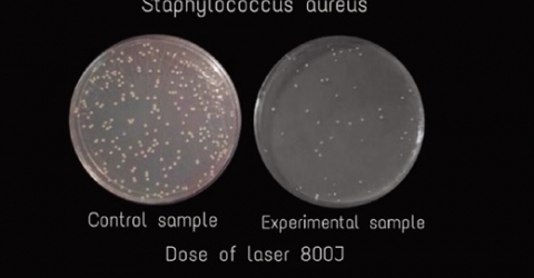 Research - immediate effect Hilterapia on staphylococcus