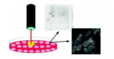 Effect of IR laser on myoblasts: a proteomic study