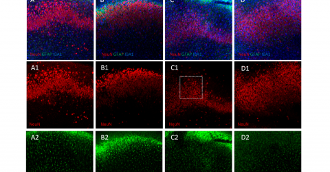 NIR Laser PBM Neuroprotection of Cerebral Hypoxia/Ischemia